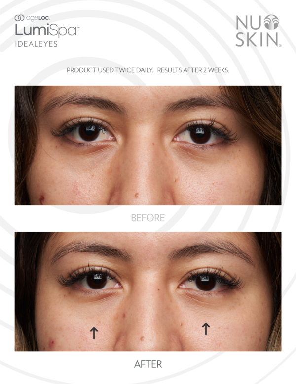 Nu Skin Ageloc Lumispa accent Kit ideal eyes reviews before and after results
