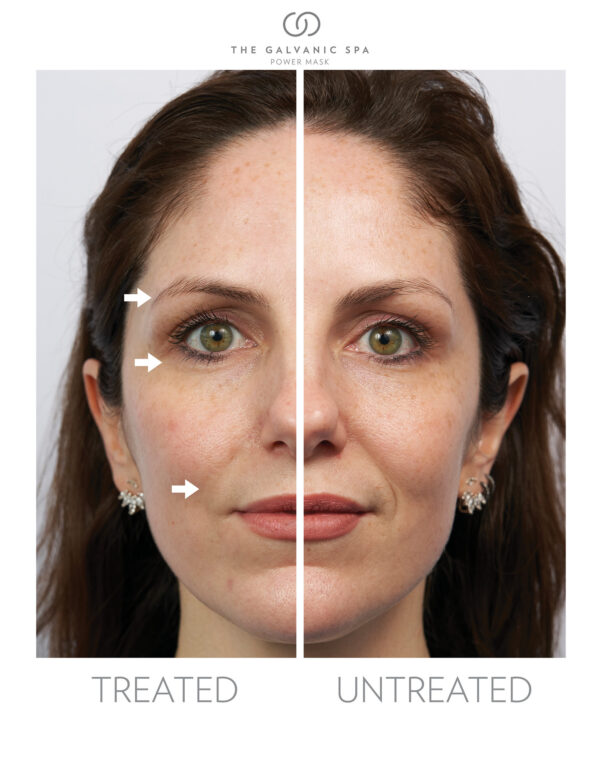 Nu skin facial spa reviews before and after results