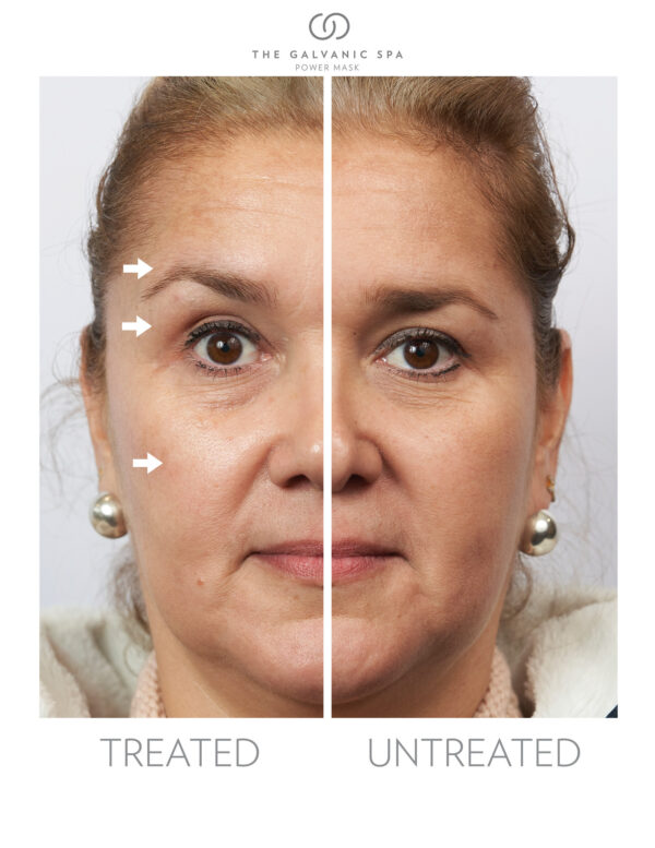 Nu skin facial spa reviews before and after results