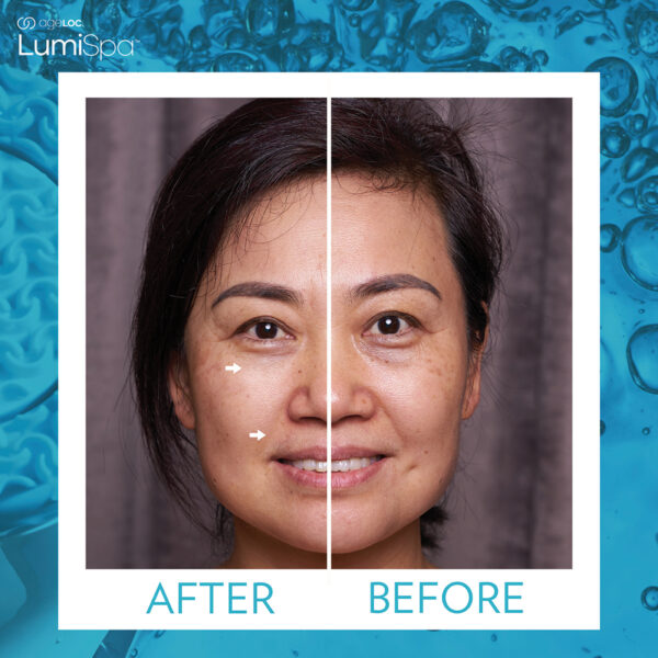 Nu Skin Ageloc Lumispa Kit reviews before and after results
