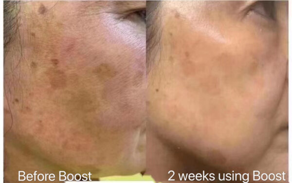 Nu Skin Ageloc Boost reviews before and after results