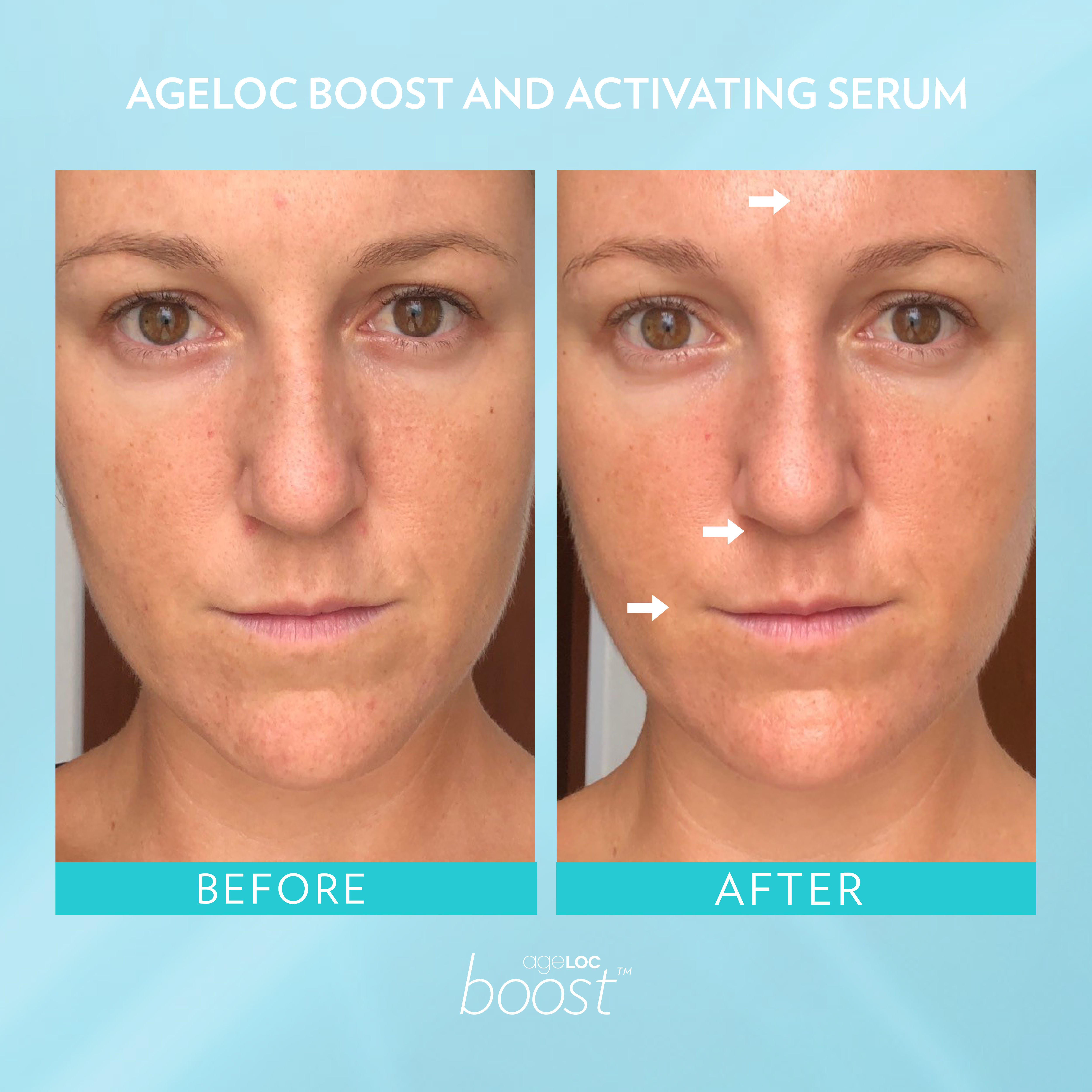 Nu Skin Ageloc Boost reviews before and after results - nubeautyonline