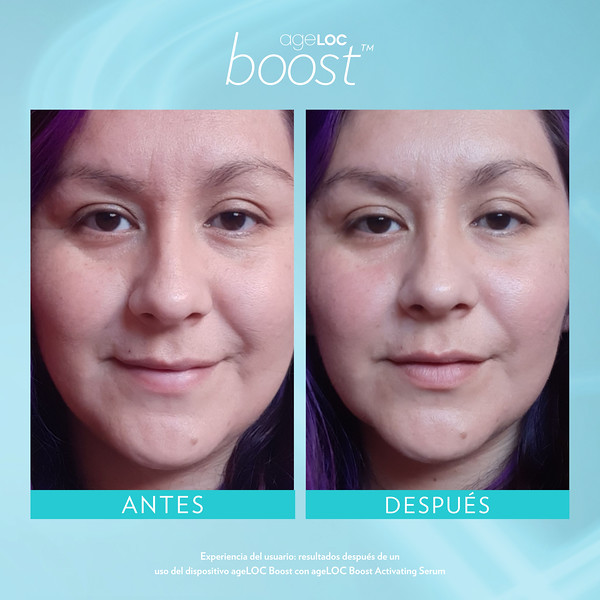 Nu Skin Ageloc Boost reviews before and after results - nubeautyonline