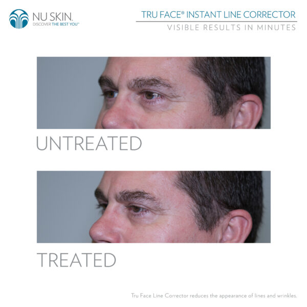 Nu skin tru face line corrector reveiws before and after results