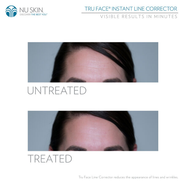 Nu skin tru face line corrector reveiws before and after results - nubeautyonline.com