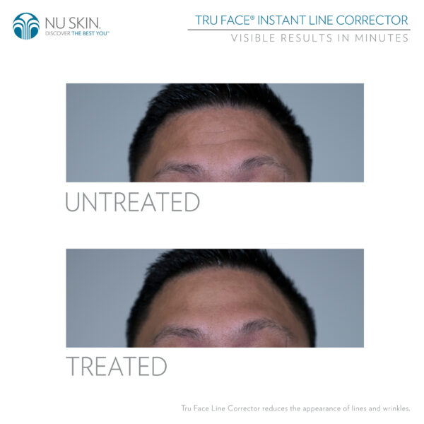 Nu skin tru face line corrector reveiws before and after results - nubeautyonline.nexgenpackages.com