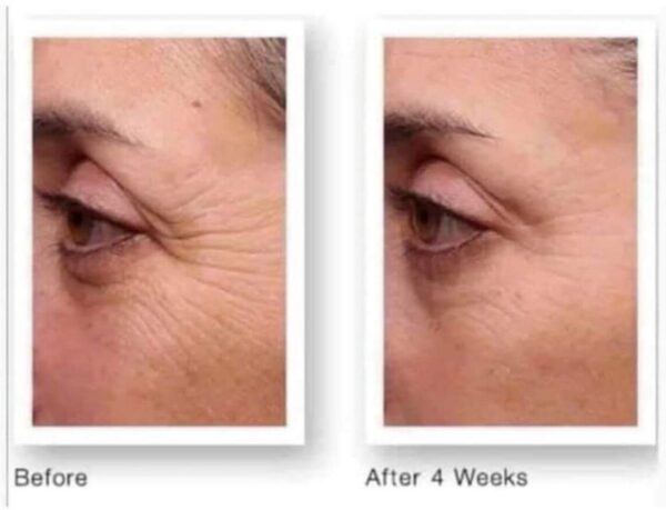 Nu skin tru face line corrector reveiws before and after results - nubeautyonline.nexgenpackages.com