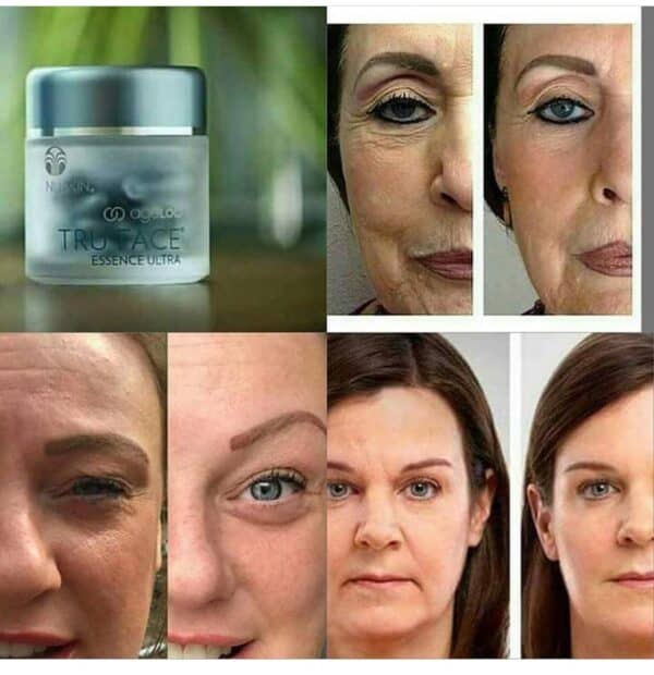 NU-SKIN-AGELOC®-TRU-FACE®-ESSENCE-ULTRA-BEFORE AND AFTER
