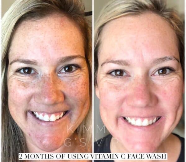 Nuskin 180 Anti-Aging Skin Therapy System Face Wash Before and After 3