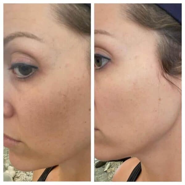 Nuskin 180 Anti-Aging Skin Therapy System Face Wash Before and After 7