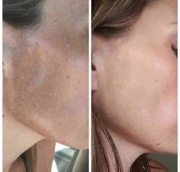 Nuskin 180 Anti-Aging Skin Therapy System Face Wash Before and After 9